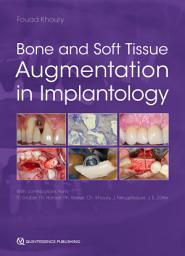 Icon image Bone and Soft Tissue Augmentation in Implantology