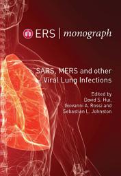 Icon image SARS, MERS and other Viral Lung Infections: ERS Monograph