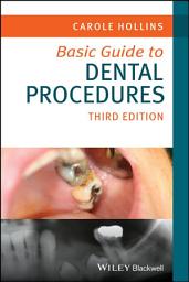 Icon image Basic Guide to Dental Procedures: Edition 3