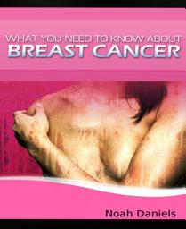 Icon image What You Need to Know About Breast Cancer