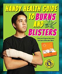 Icon image Handy Health Guide to Burns and Blisters