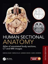 Icon image Human Sectional Anatomy: Atlas of annotated body sections, CT and MRI images, Edition 5