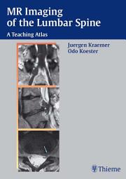 Icon image MR Imaging of the Lumbar Spine: A Teaching Atlas