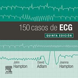 Icon image 150 casos de ECG: Edición 5