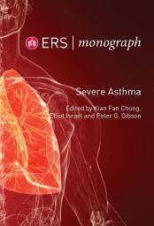 Icon image Severe Asthma