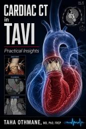 Icon image Cardiac CT in TAVI: Practical Insights