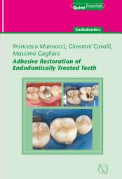 Icon image Adhesive Restoration of Endodontically Treated Teeth