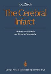Icon image The Cerebral Infarct: Pathology, Pathogenesis, and Computed Tomography