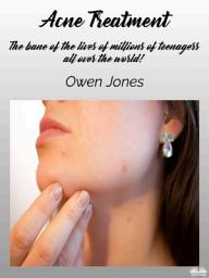 Icon image Acne Treatment: The bane of the lives of millions of teenagers all over the world!