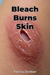 Icon image Bleach Burns Skin