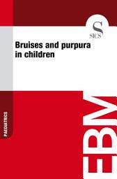 Icon image Bruises and purpura in children