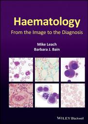 Icon image Haematology: From the Image to the Diagnosis