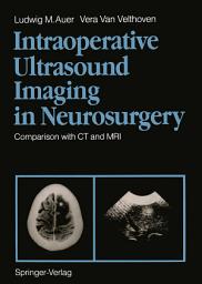 Icon image Intraoperative Ultrasound Imaging in Neurosurgery: Comparison with CT and MRI